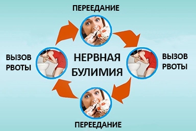 Лечение булимии в Балашове